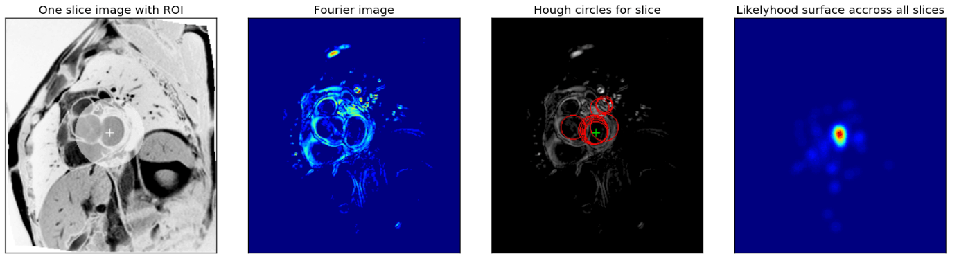 当AlphaGo战胜李世石以后，我们来聊聊深度学习